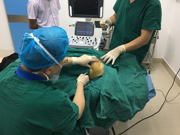 超声引导下真空辅助乳腺微创旋切术.png