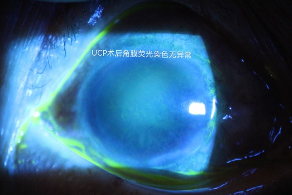 术后2.png